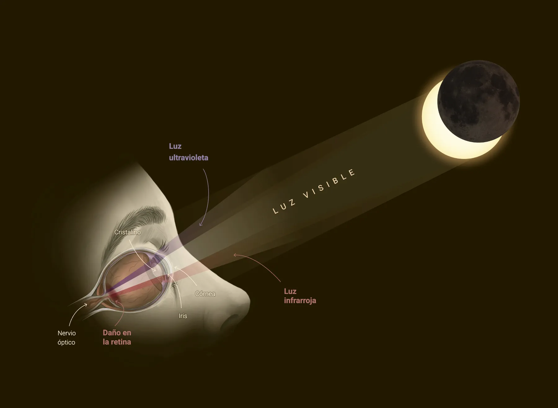 Anatomía del ojo mostrando cómo la luz ultravioleta e infrarroja del Sol puede dañar la retina
