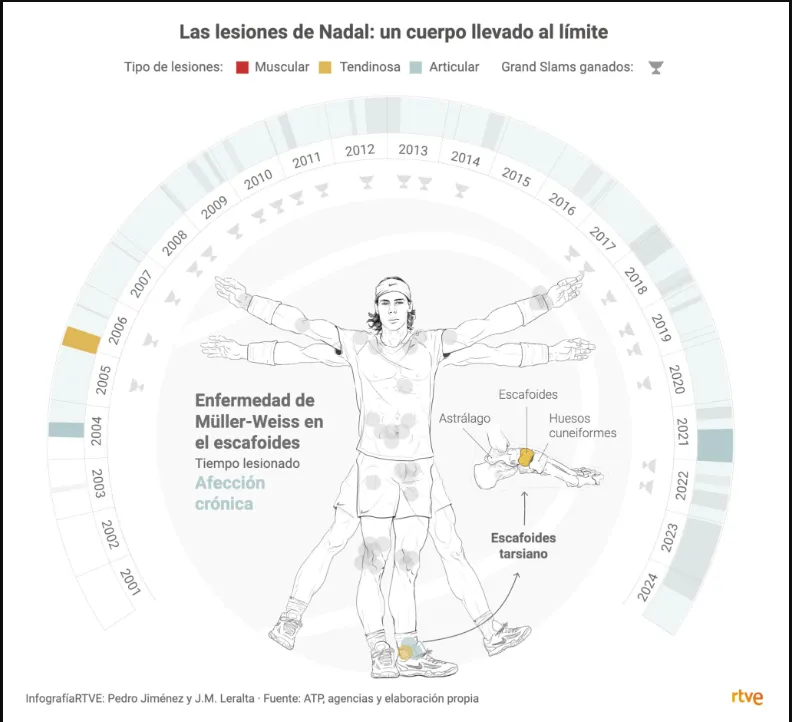 Gráfico circular con la cronología de las lesiones de Rafa Nadal durante toda su carrera